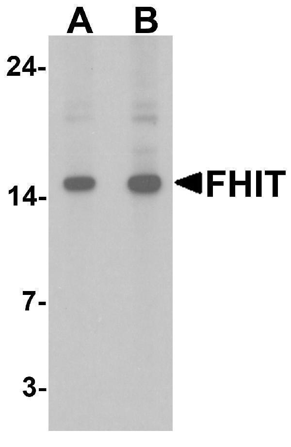 a01200 fhit primary antibodies wb testing 1