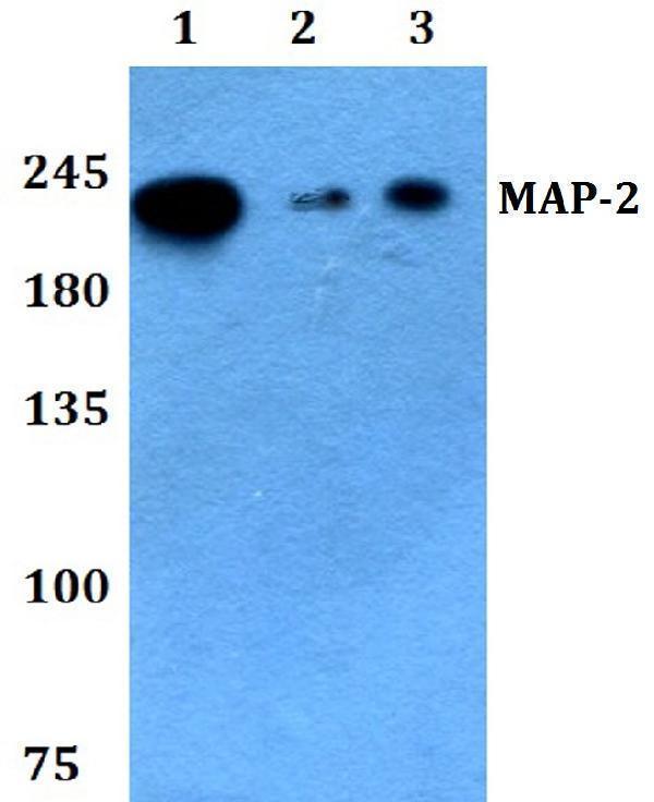 a01201 3 map2 primary antiboties wb testing 1