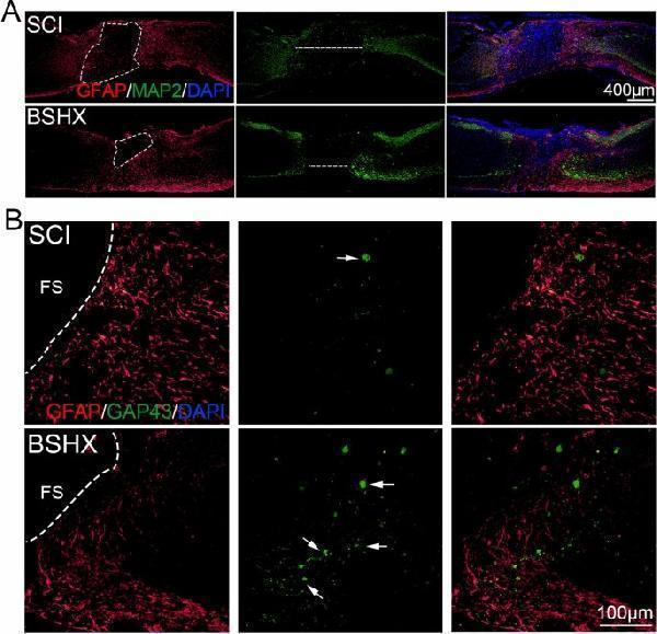 BSHX decoction decreased the damage of tissue and promoted axon regeneration after SCI