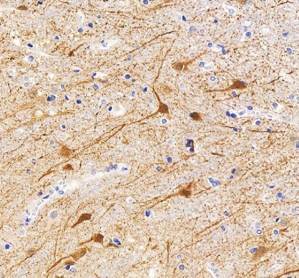 IHC analysis of MAP2 using anti-MAP2 antibody (A01201-4)