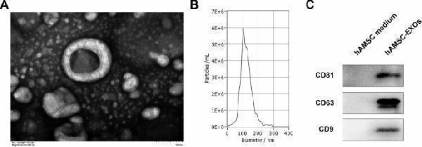 Identification of hAMSC-Exos ( A ) The morphology of hAMSC-Exos was observed using transmission electron microscopy