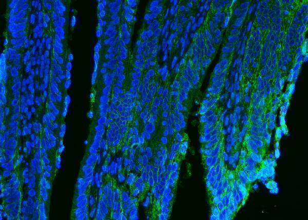 a01202 2 cd9 primary antibodies if testing 4