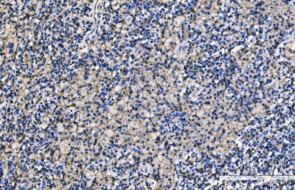  IHC analysis of CD9 using anti-CD9 antibody (A01202-2)