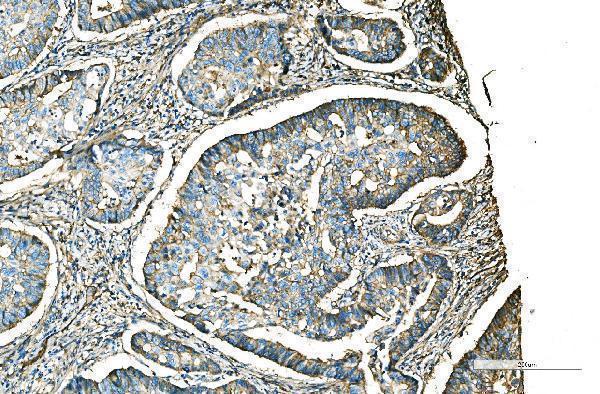 a01202 2 cd9 primary antibodies ihc testing 3