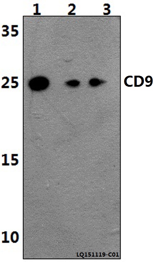 Western blot (WB) analysis of CD9 (Y129) polyclonal antibody at 1:500 dilution
Lane1:THP-1 whole cell lysate(40ug)
Lane2:The Peripheral blood cells tissue lysate of Rat(30ug)
Lane3:The Peripheral blood cells tissue lysate of Mouse(30ug)