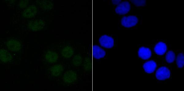a01203 1 sin3a primary antiboties icc testing 2