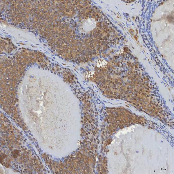  IHC analysis of mSin3A/SIN3A using anti-mSin3A/SIN3A antibody (A01203-2)