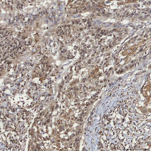  IHC analysis of mSin3A/SIN3A using anti-mSin3A/SIN3A antibody (A01203-2)