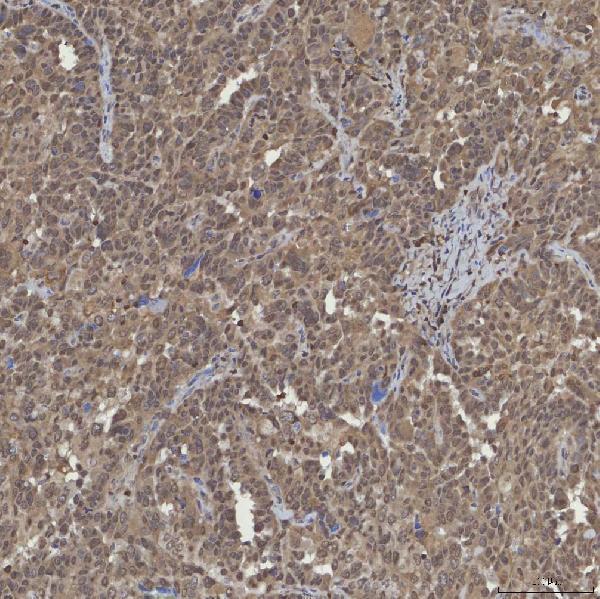 a01203 2 sin3a primary antibodies ihc testing 5