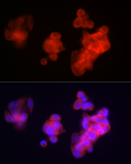 a01204 fgb primary antiboties if testing 3