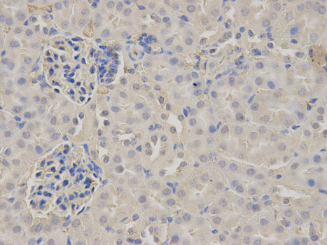 a01204 fgb primary antiboties wb testing 2