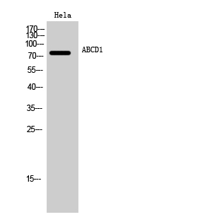 a01205 abcd1 primary antibodies wb testing 2
