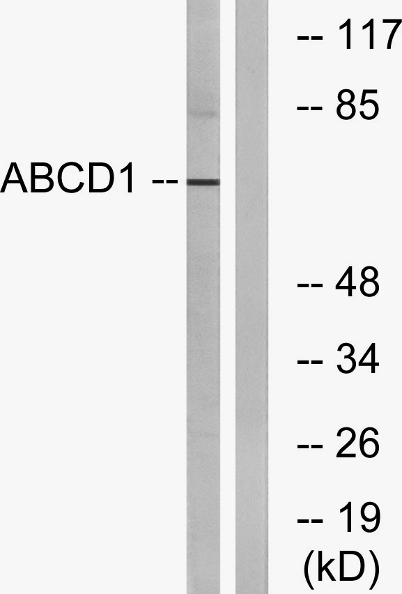a01205 abcd1 primary antibodies wb testing 3