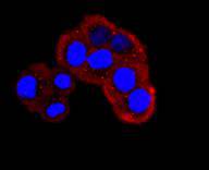 ICC staining NUMB in Hela cells (red)