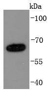 Western blot analysis of NUMB on A431 cells lysates using anti-NUMB antibody at 1/1,000 dilution