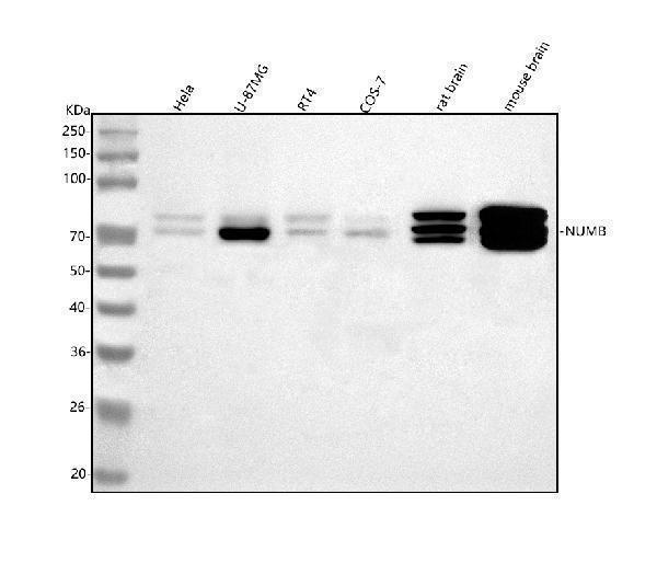  Western blot analysis of NUMB using anti-NUMB antibody (A01206-2)