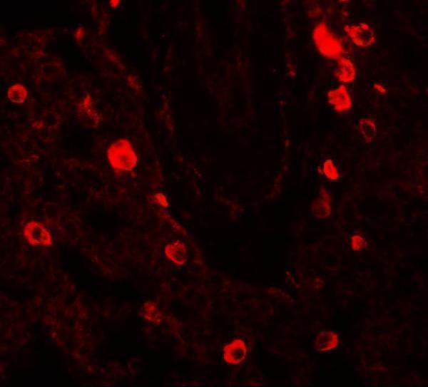 Immunofluorescence of NUMB in human lung tissue with NUMB antibody at 20 μg/mL