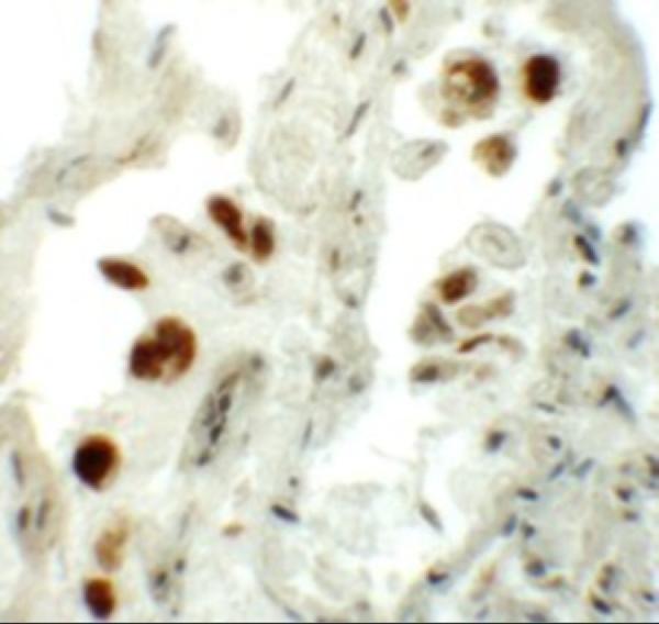 Immunohistochemistry of NUMB in human lung tissue with NUMB antibody at 5 μg/mL
