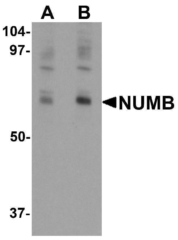 Western blot analysis of NUMB in mouse lung tissue lysate with NUMB antibody at (A) 0