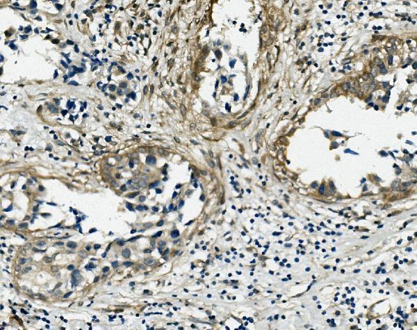 a01207 1 vcl primary antibodies ihc testing 4_1