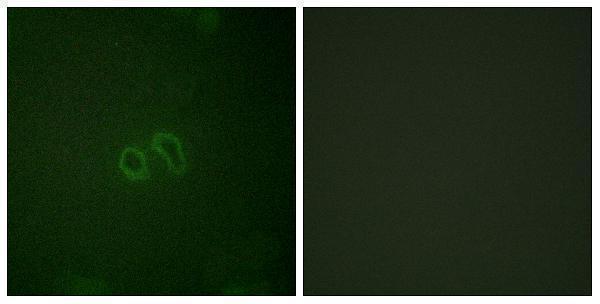 Immunofluorescence analysis of HepG2 cells, using Vinculin (Phospho-Tyr821) Antibody