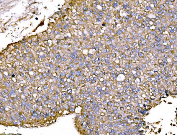  IHC analysis of P2X7/P2RX7 using anti-P2X7/P2RX7 antibody (A01208-3)