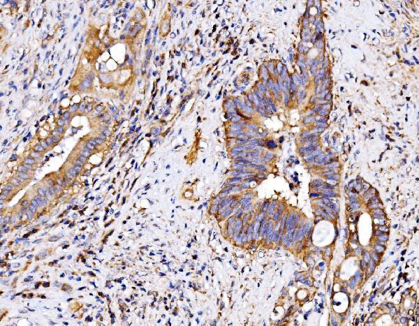 a01208 3 p2rx7 primary antibodies ihc testing 3
