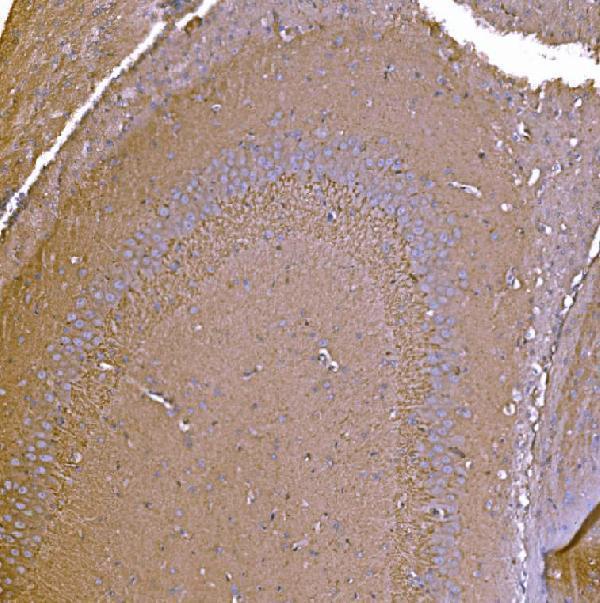 a01208 3 p2rx7 primary antibodies ihc testing 4