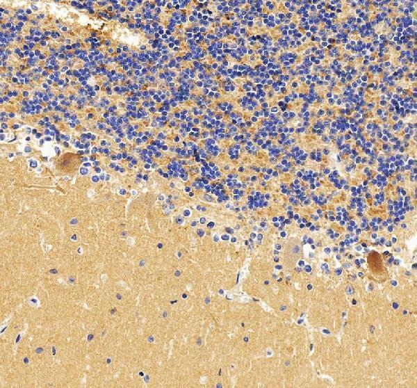a01208 3 p2rx7 primary antibodies ihc testing 5