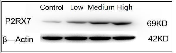  Western blot analysis of P2X7/P2RX7 using anti-P2X7/P2RX7 antibody (A01208-3)
