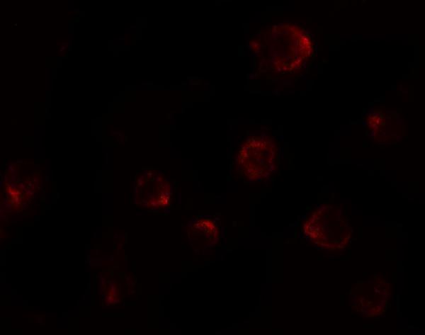 a01208 p2rx7 primary antibodies if testing 3