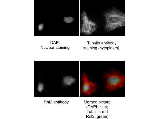 Immunofluorescence Microscopy of Goat anti-RING1B antibody