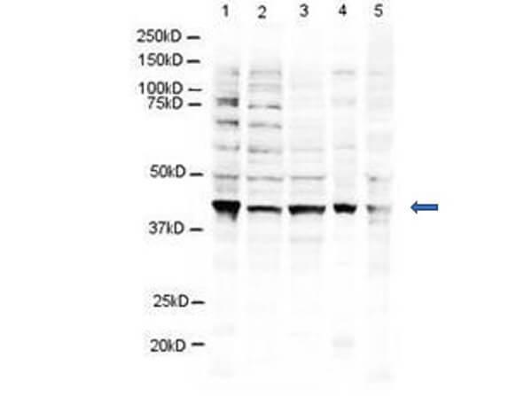 Western blot using Boster