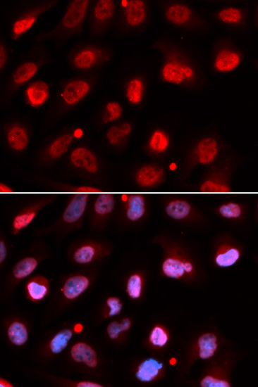 Immunohistochemistry of paraffin-embedded mouse kidney using RING1B/RNF2 Rabbit pAb  at dilution of 1:50 