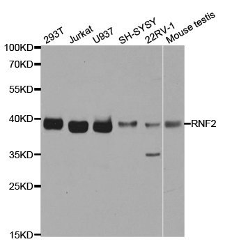 Western blot analysis of Jurkat, using RING1B/RNF2 antibody  at  1:490 dilution