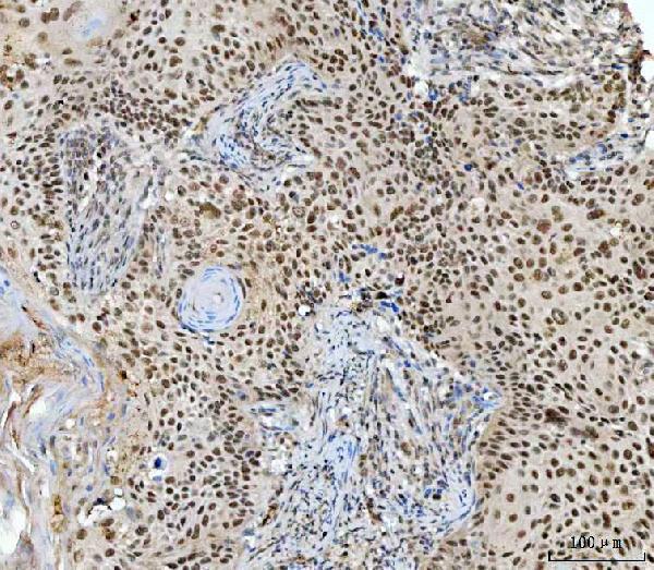 IHC analysis of RING2/RING1B/RNF2 using anti-RING2/RING1B/RNF2 antibody (A01209-3)