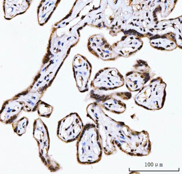  IHC analysis of RING2/RING1B/RNF2 using anti-RING2/RING1B/RNF2 antibody (A01209-3)