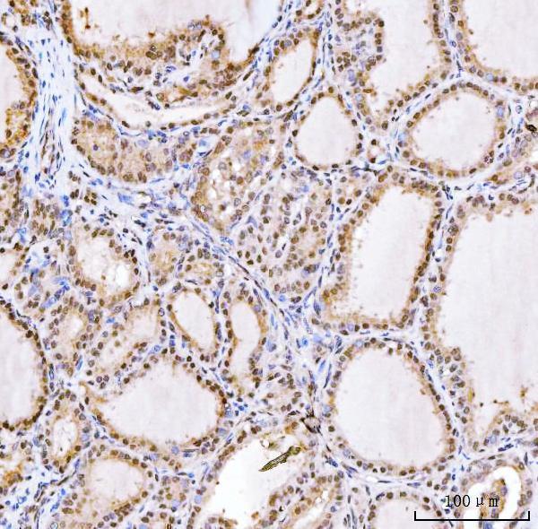 a01209 3 rnf2 primary antibodies ihc testing 4