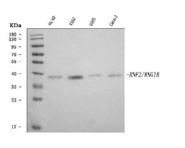  Western blot analysis of RING2/RING1B/RNF2 using anti-RING2/RING1B/RNF2 antibody (A01209-3)