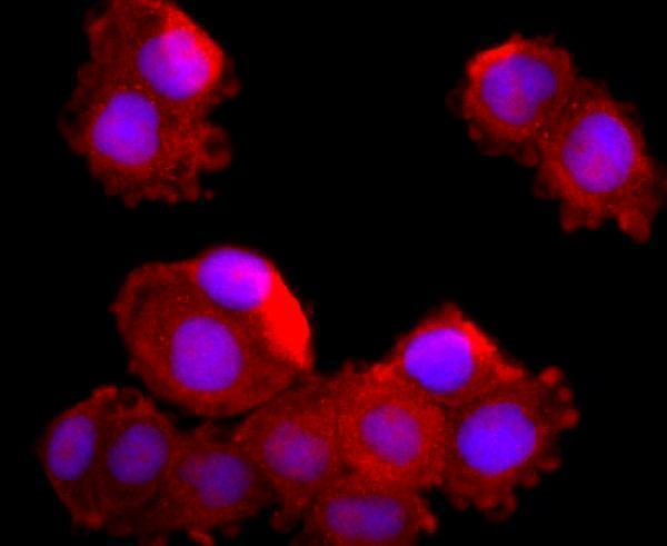 ICC staining MUC2 in Hela cells (red)