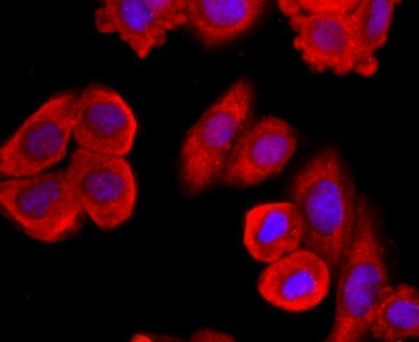 ICC staining MUC2 in HepG2 cells (red)