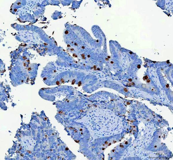 IHC analysis of MUC2 using anti-MUC2 antibody (A01212-2)