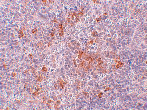 Immunohistochemistry of AGTR1 in mouse kidney tissue with AGTR1 antibody at 2