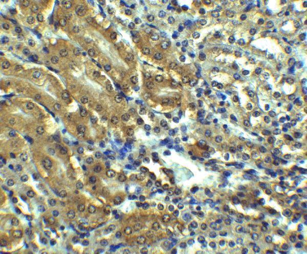 a01213 agtr1 primary antibodies ihc testing 4