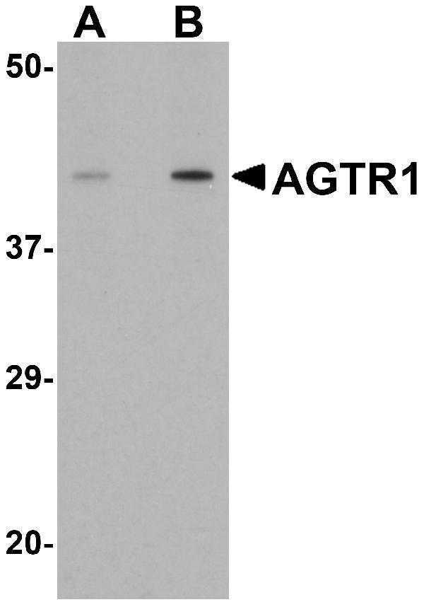 Western blot analysis of AGTR1 in mouse kidney tissue lysate with AGTR1 antibody at (A) 1 and (B) 2 μg/mL
