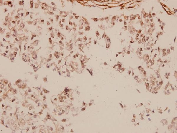 a01214 mta1 primary antiboties ihc testing 2