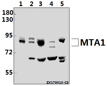 a01214 mta1 primary antiboties wb testing 1