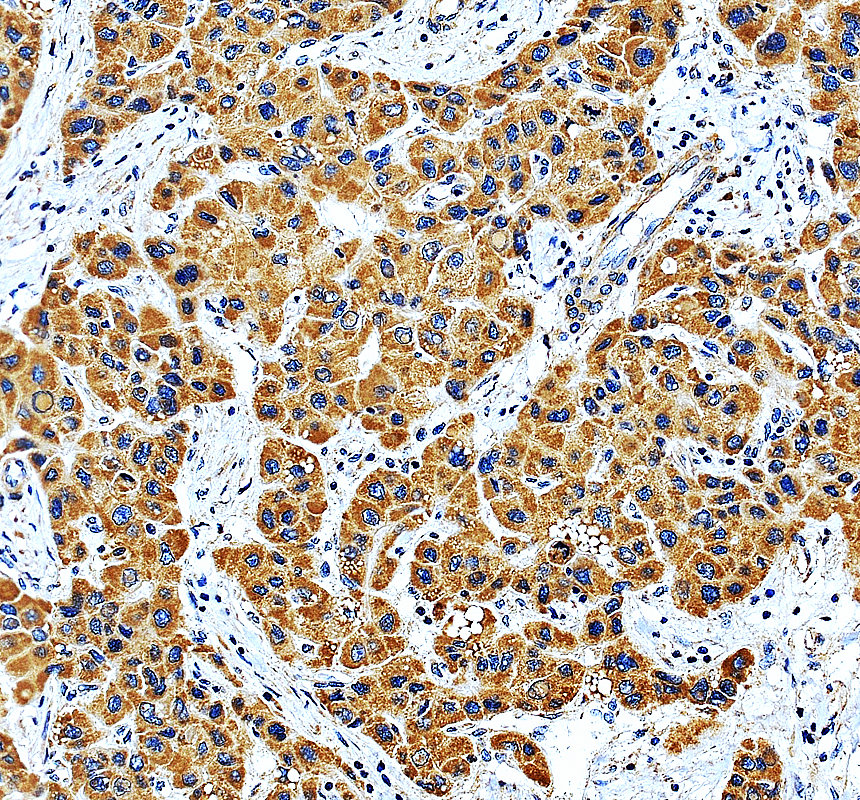 a01216 2 il6st primary antibodies ihc testing 1