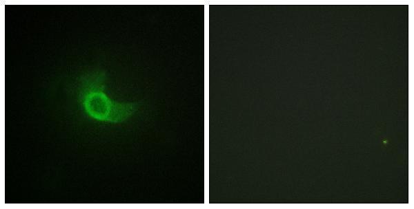 a01216 il6st primary antibodies if testing 1