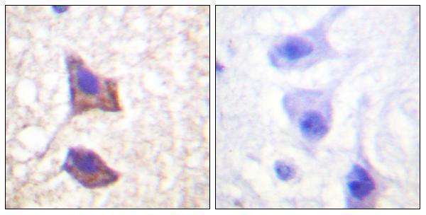 a01216 il6st primary antibodies ihc testing 4